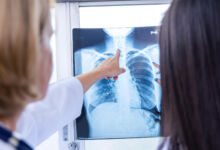 radiologia
