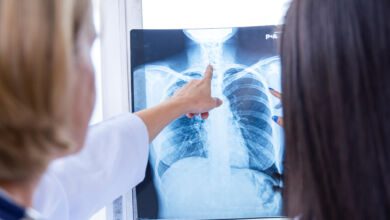 radiologia